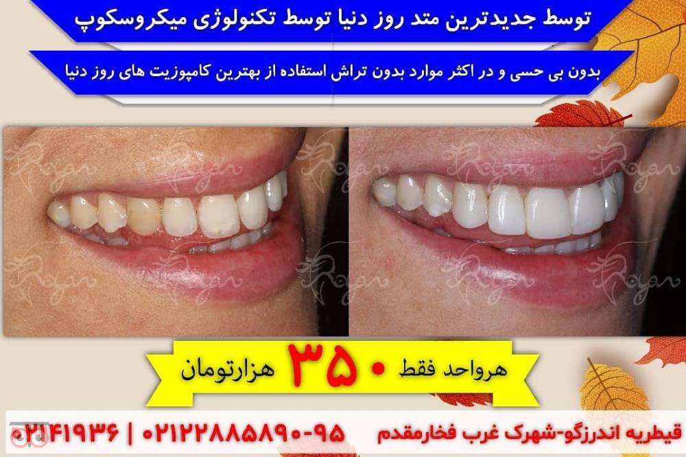 تخفیف ویژه لمینیت تخفیف ویژه لمینیت