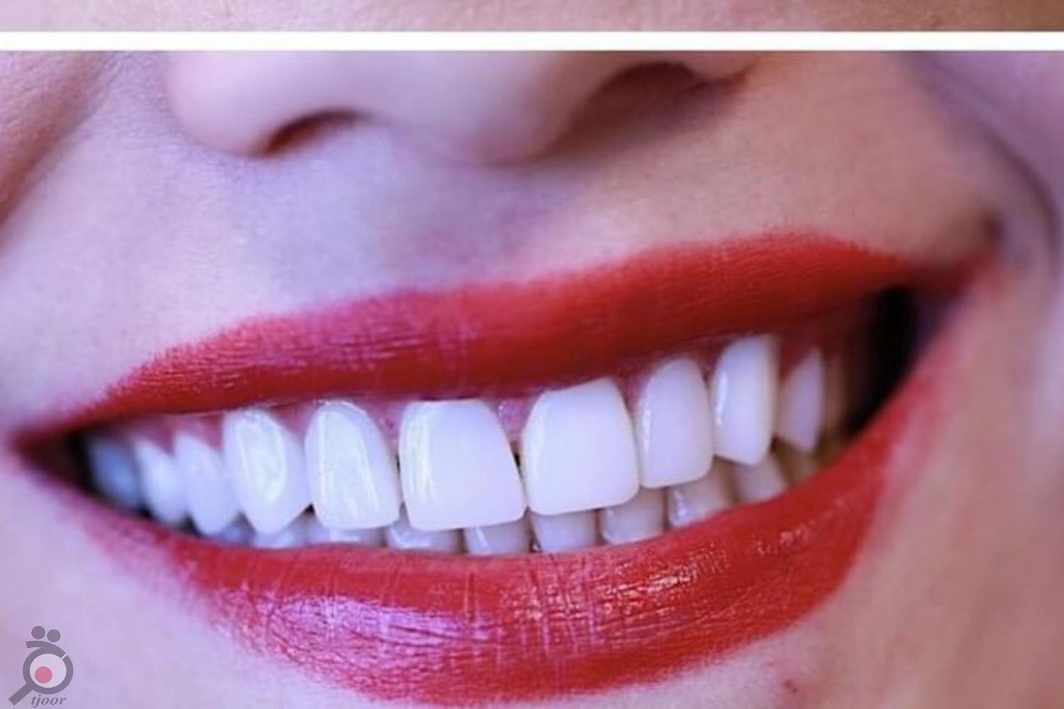 تخفیف ویژه کامپوزیت تخفیف ویژه کامپوزیت