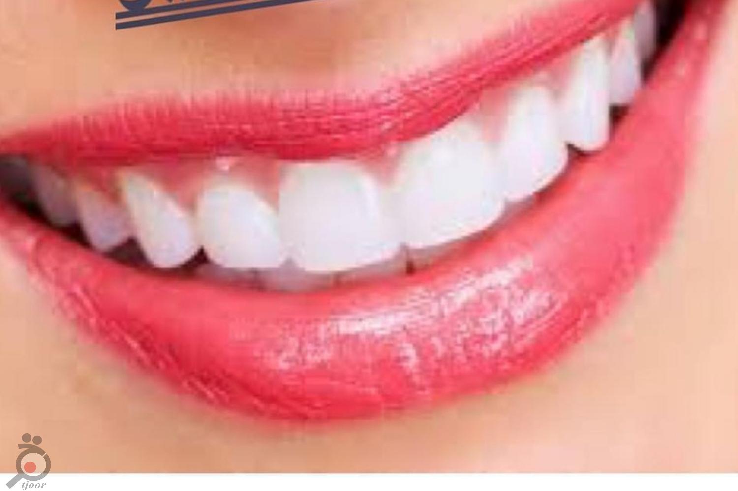 تخفیف ویژه پاییزی تخفیف ویژه پاییزی