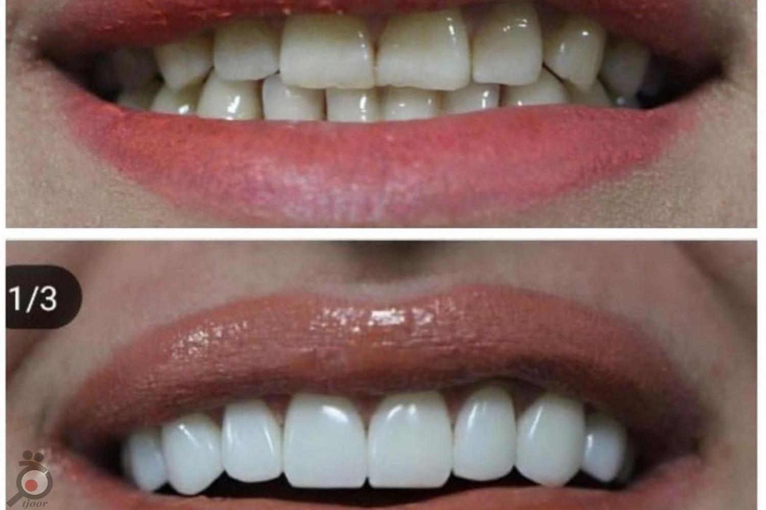 تخفیف ویژه پاییزی تخفیف ویژه پاییزی