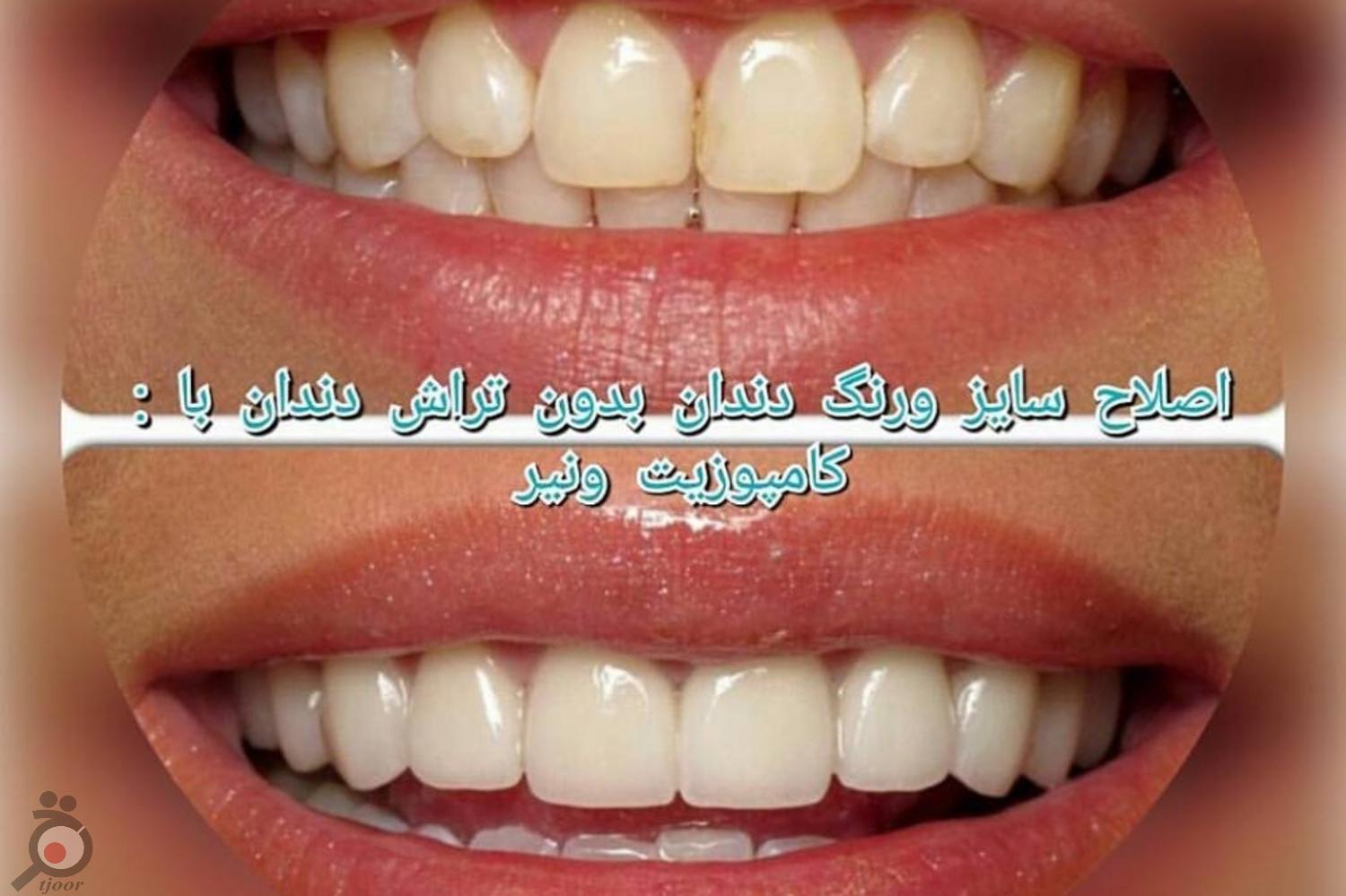 تخفیف ویژه پاییزی تخفیف ویژه پاییزی