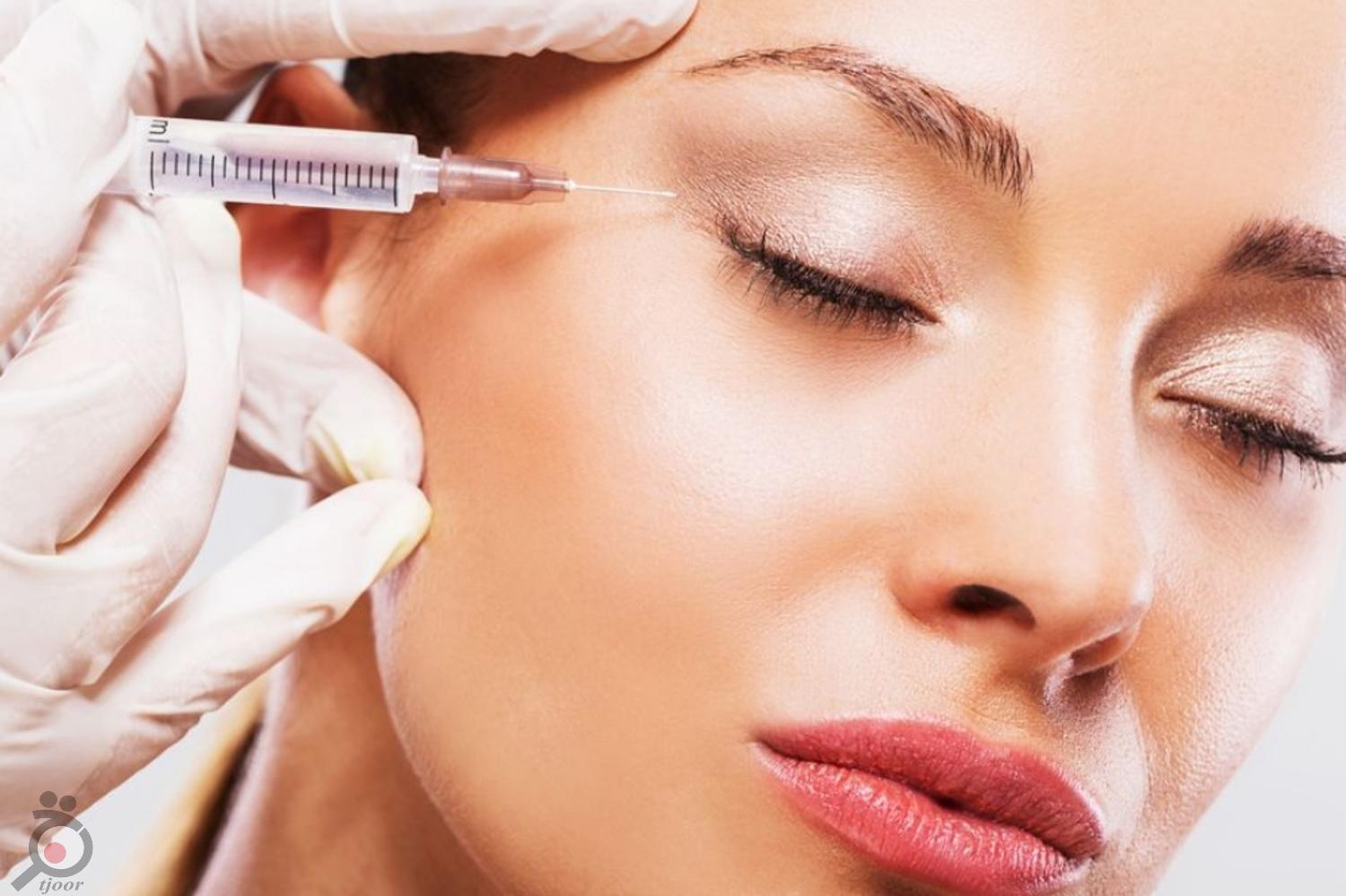 تخفیف ویژه بوتاکس تخفیف ویژه بوتاکس