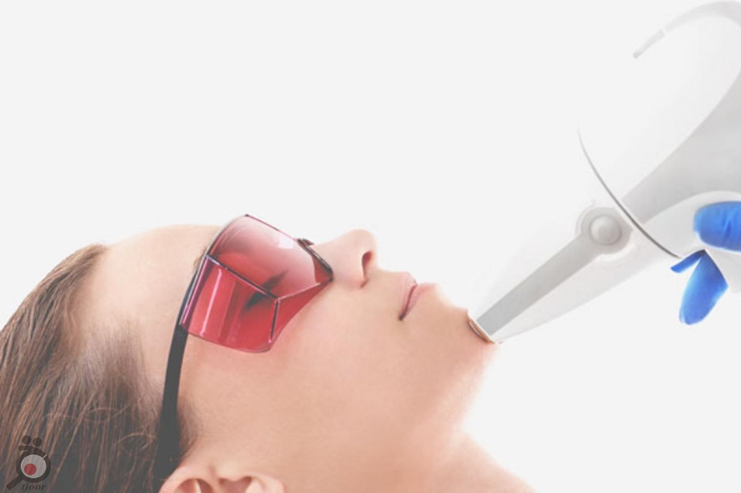 تخفیف ویژه لیزر تخفیف ویژه لیزر