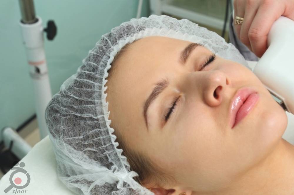 تخفیف ویژه لیزر تخفیف ویژه لیزر