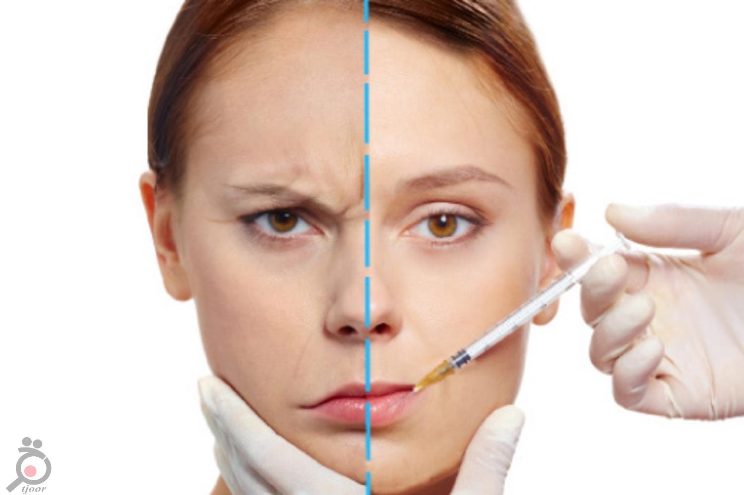 جشنواره تزریق ژل لب جشنواره تزریق ژل لب