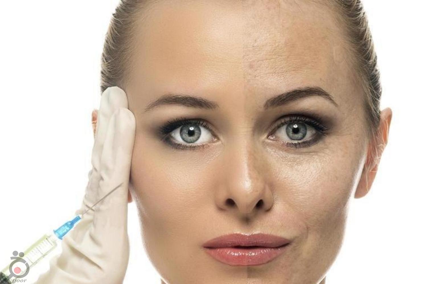 جشنواره تزریق ژل لب جشنواره تزریق ژل لب