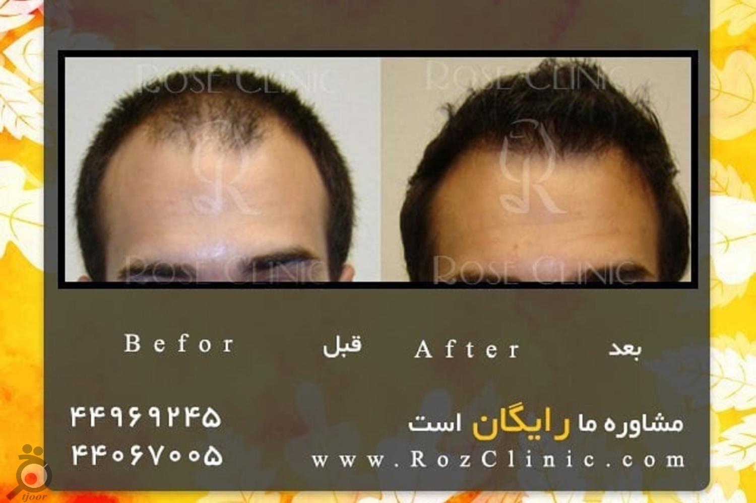 تخفیف ویژه خدمات تخفیف ویژه خدمات