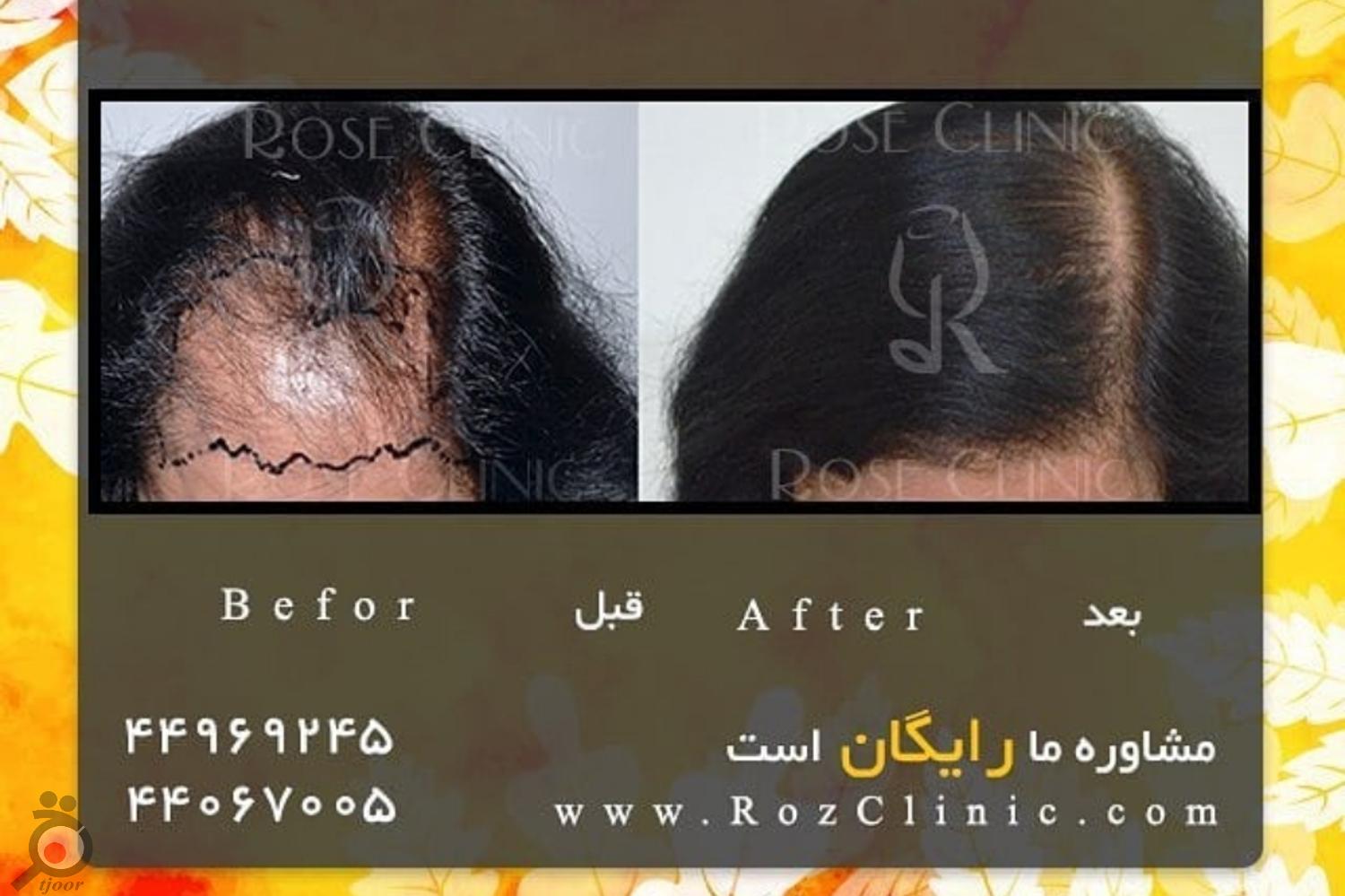 تخفیف ویژه خدمات تخفیف ویژه خدمات