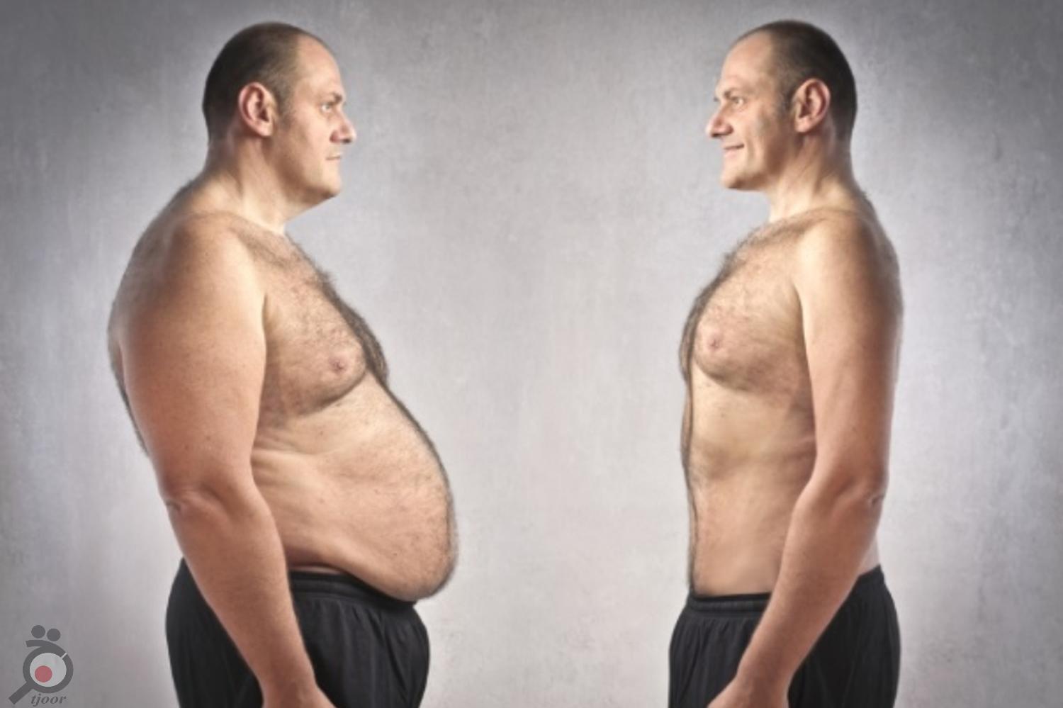 تخفیف زمستانه ماستوپکسی تخفیف زمستانه ماستوپکسی