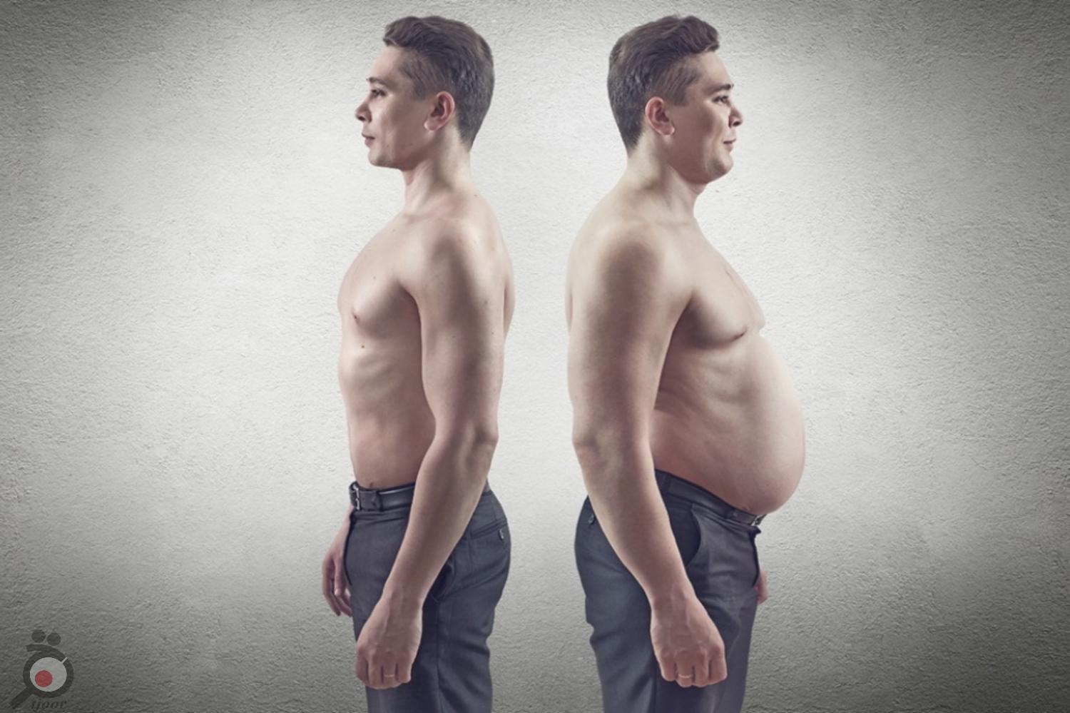 تخفیف زمستانه ماستوپکسی تخفیف زمستانه ماستوپکسی