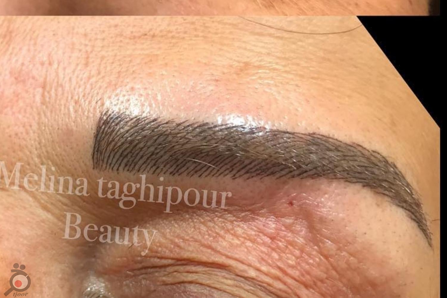 تخفیف ویژه انجام میکروپیگمنتیشن ابرو تخفیف ویژه انجام میکروپیگمنتیشن ابرو