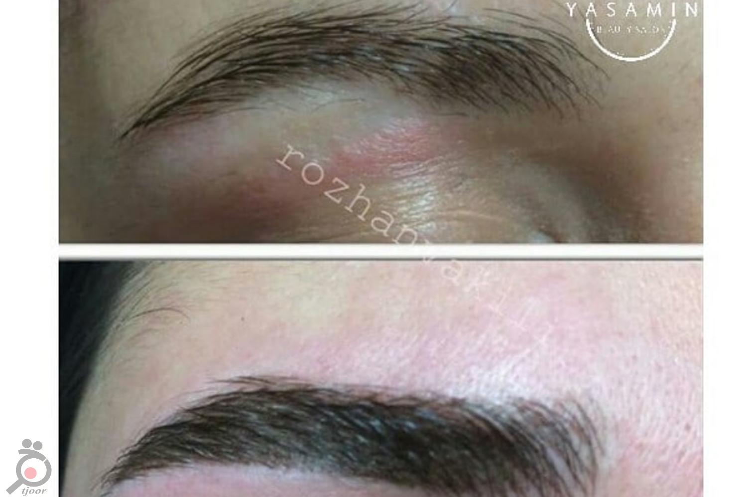 تخفیف یلدایی بر روی تمام لاین های زیبایی تخفیف یلدایی بر روی تمام لاین های زیبایی