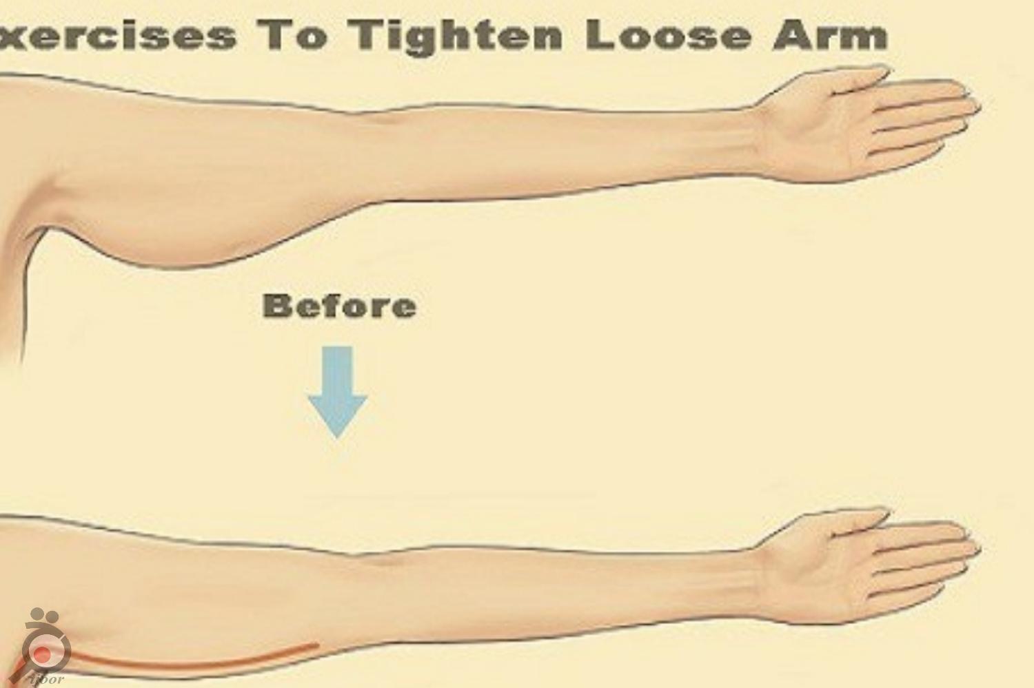 تخفیف رفع افتادگی شکم و بازو تخفیف رفع افتادگی شکم و بازو