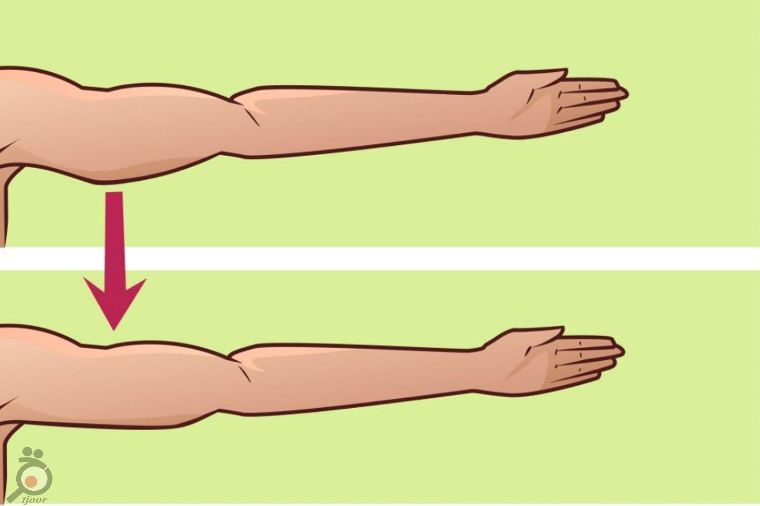 تخفیف رفع افتادگی شکم و بازو تخفیف رفع افتادگی شکم و بازو