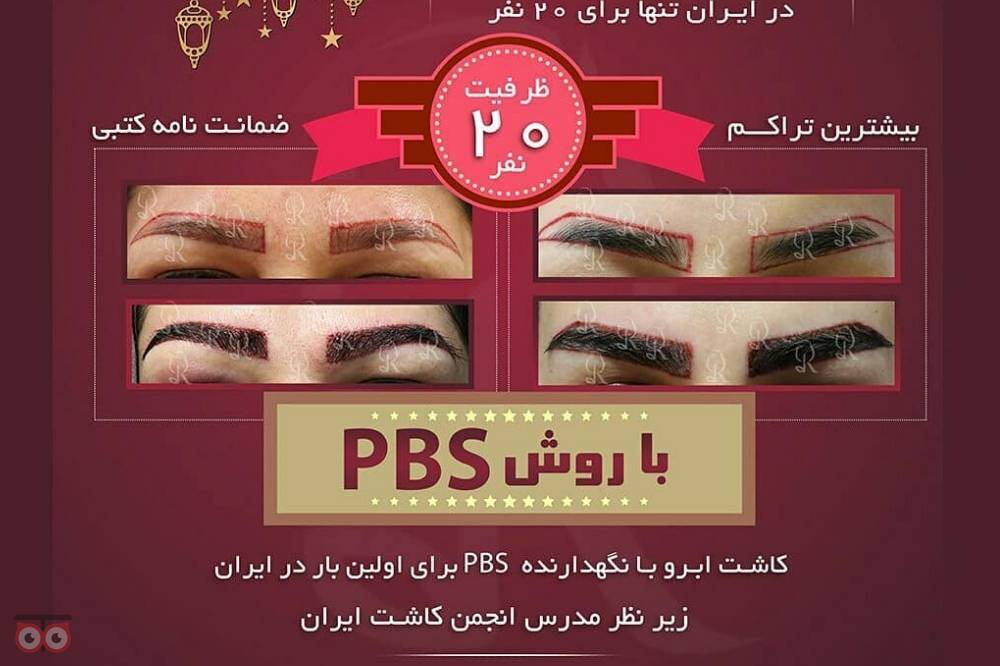 تخفیفات ویژه کلینیک رز به مناسبت ماه مبارک رمضان تخفیفات ویژه کلینیک رز به مناسبت ماه مبارک رمضان