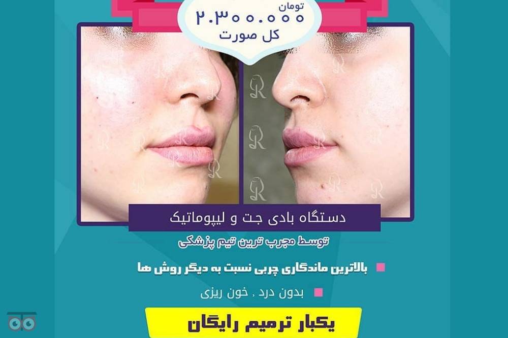 تخفیفات ویژه کلینیک رز به مناسبت ماه مبارک رمضان تخفیفات ویژه کلینیک رز به مناسبت ماه مبارک رمضان