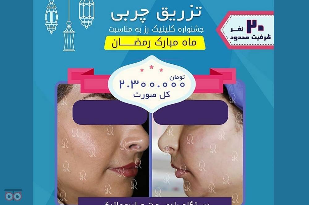 تخفیفات ویژه کلینیک رز به مناسبت ماه مبارک رمضان تخفیفات ویژه کلینیک رز به مناسبت ماه مبارک رمضان