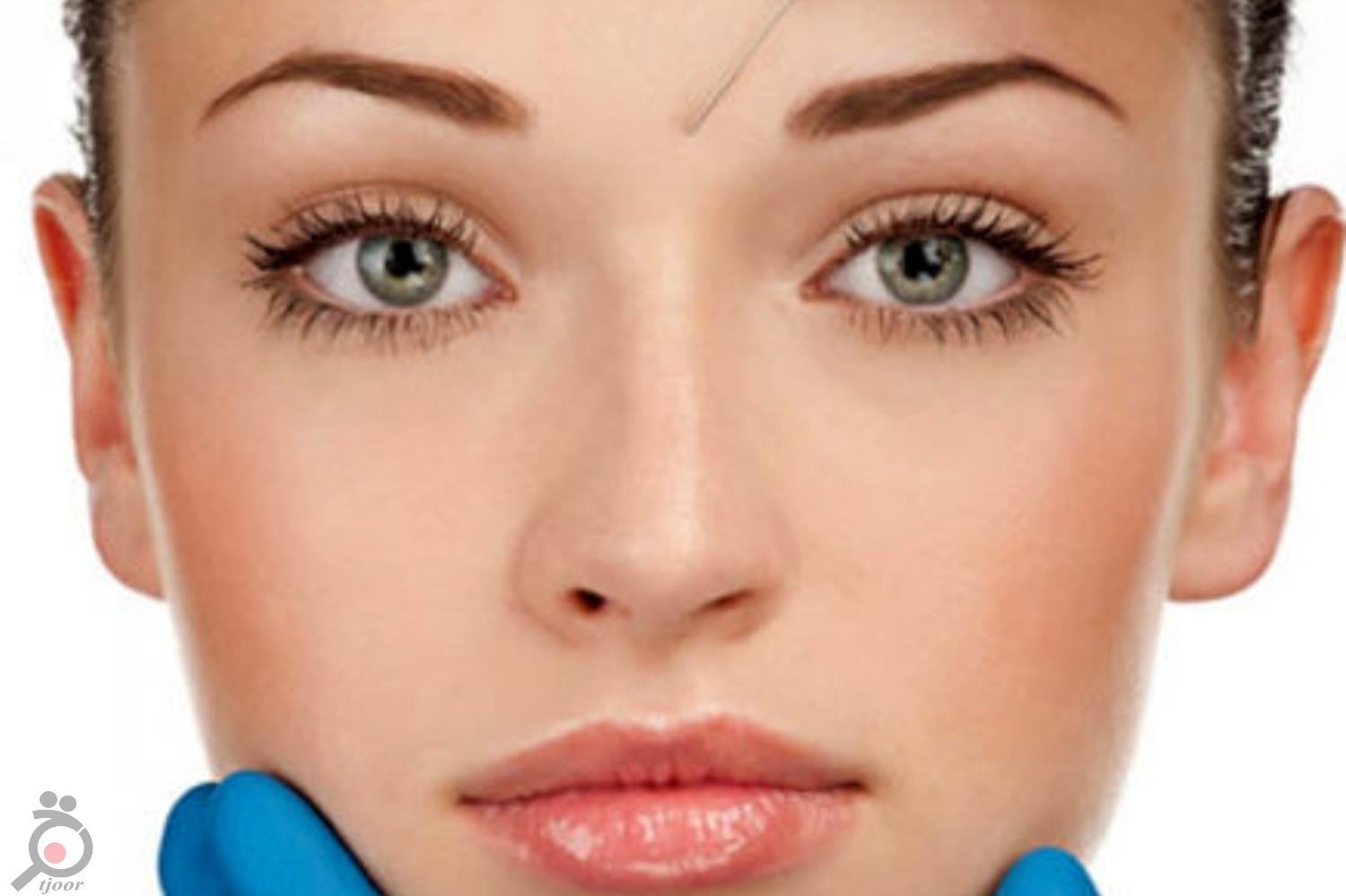 تخفیف ویژه بوتاکس تخفیف ویژه بوتاکس