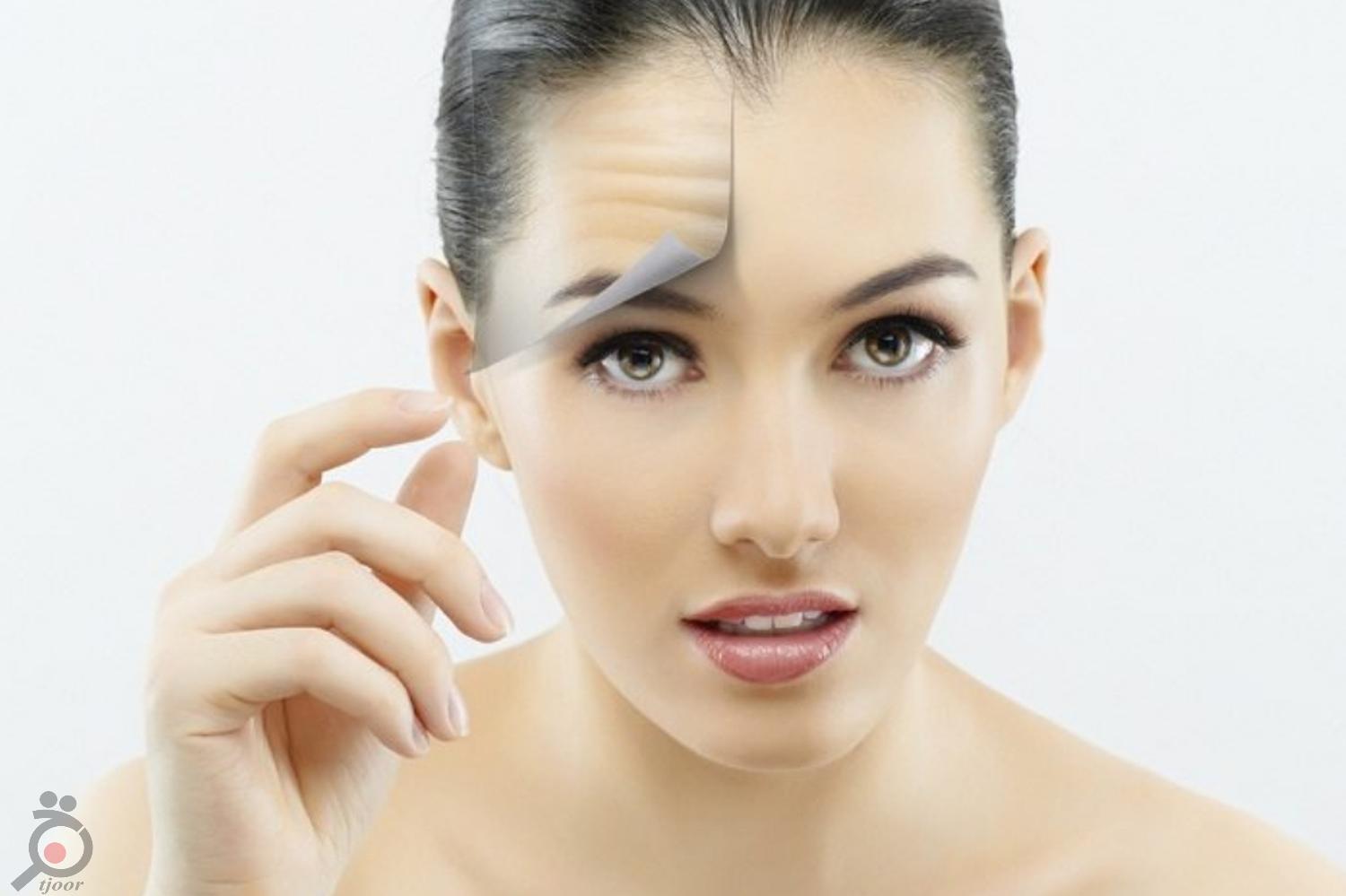 تخفیف ویژه بوتاکس تخفیف ویژه بوتاکس