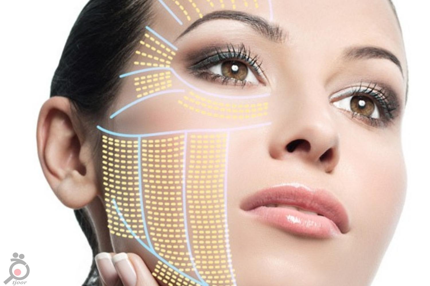 تخفیف ویژه هایفوتراپی تخفیف ویژه هایفوتراپی