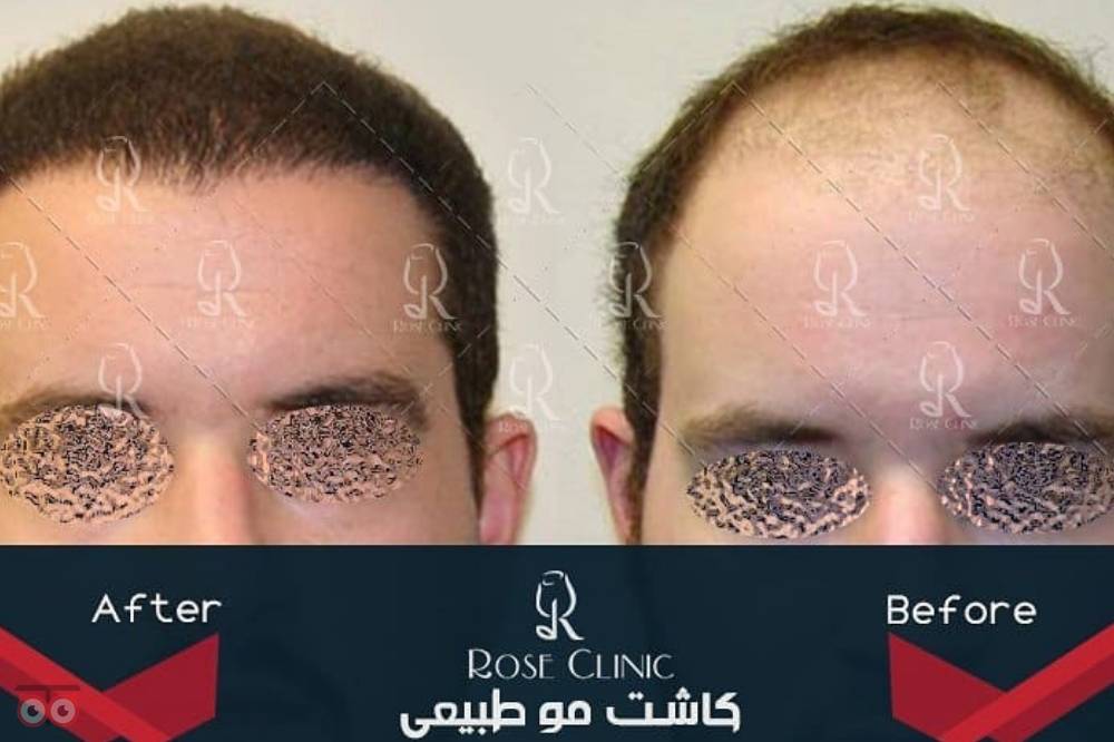 تمدید جشنواره کاشت تمدید جشنواره کاشت
