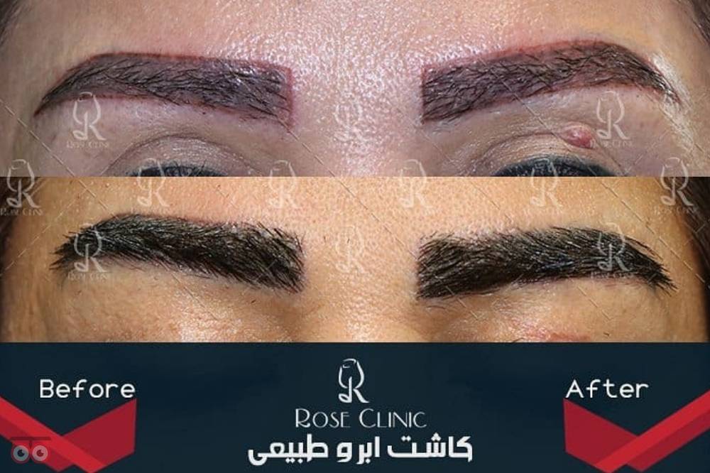 تمدید جشنواره کاشت تمدید جشنواره کاشت