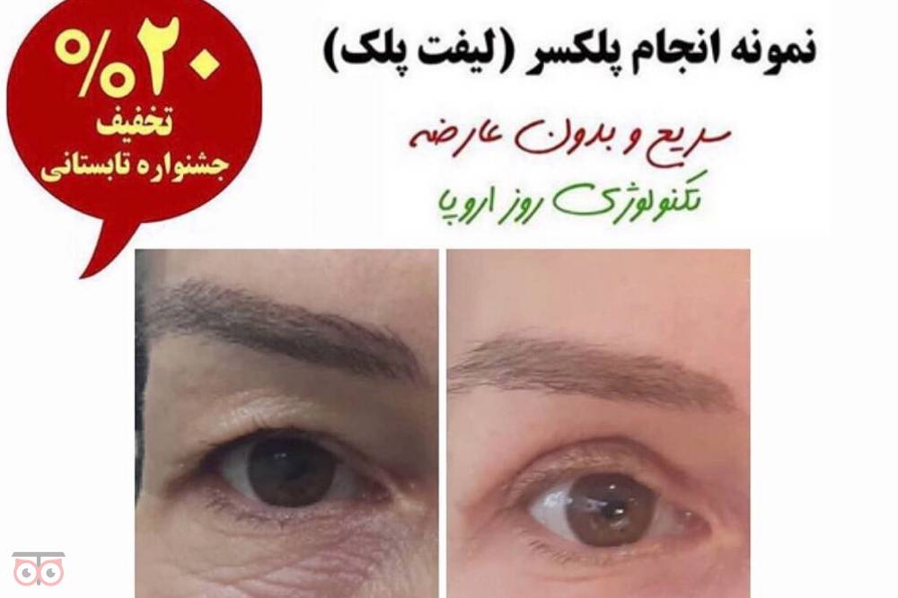 تخفیف ویژه پلکسر تخفیف ویژه پلکسر