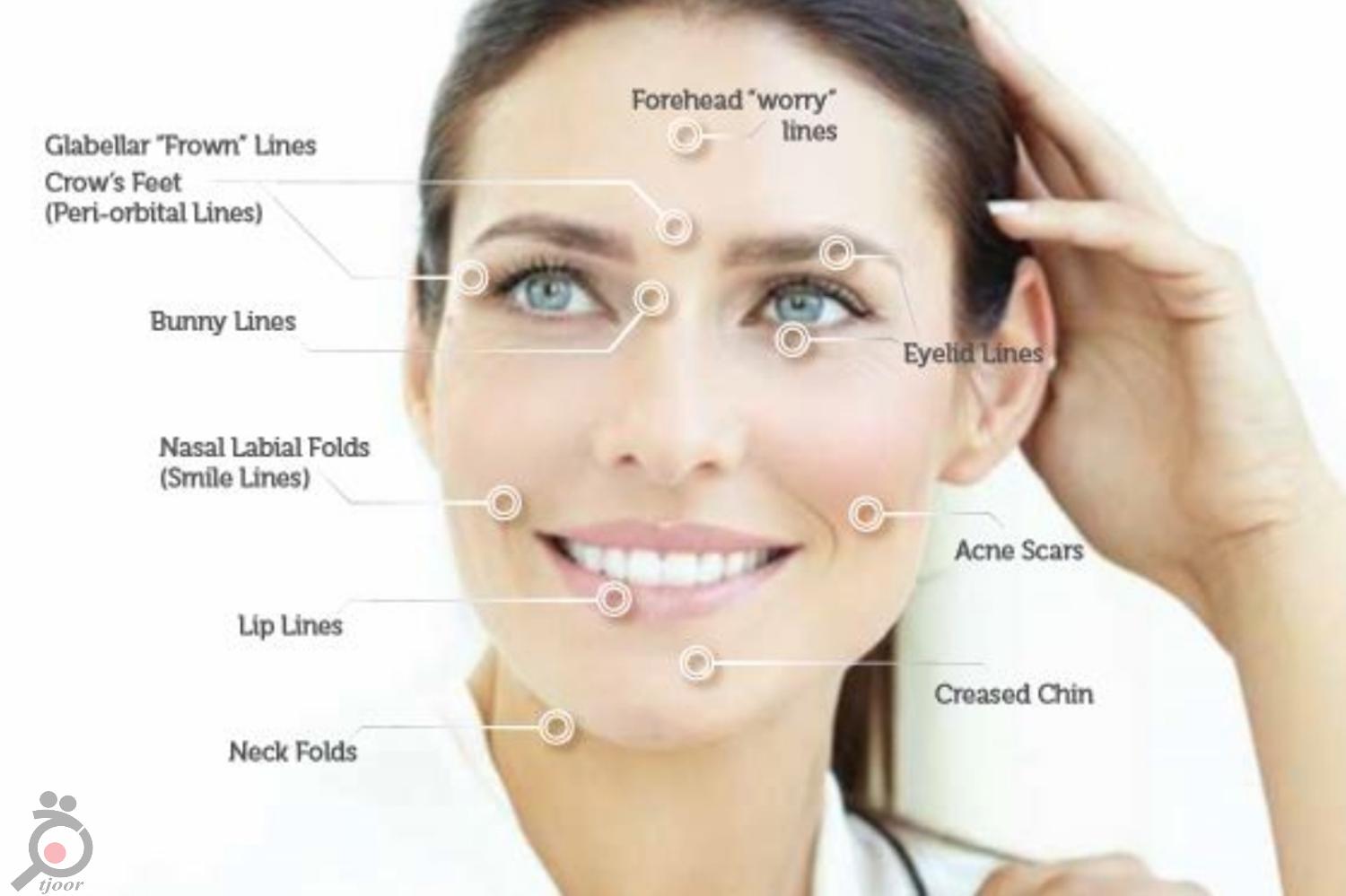 تخفیف ویژه تیکسل تخفیف ویژه تیکسل