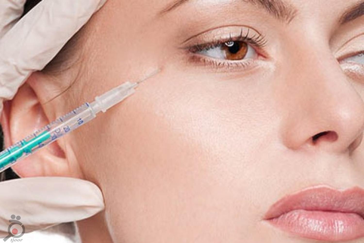 تخفیف ویژه تزریق فیلر تخفیف ویژه تزریق فیلر