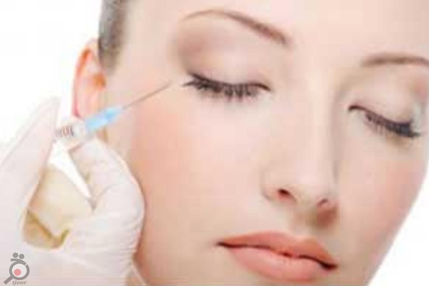 تخفیف ویژه تزریق فیلر تخفیف ویژه تزریق فیلر