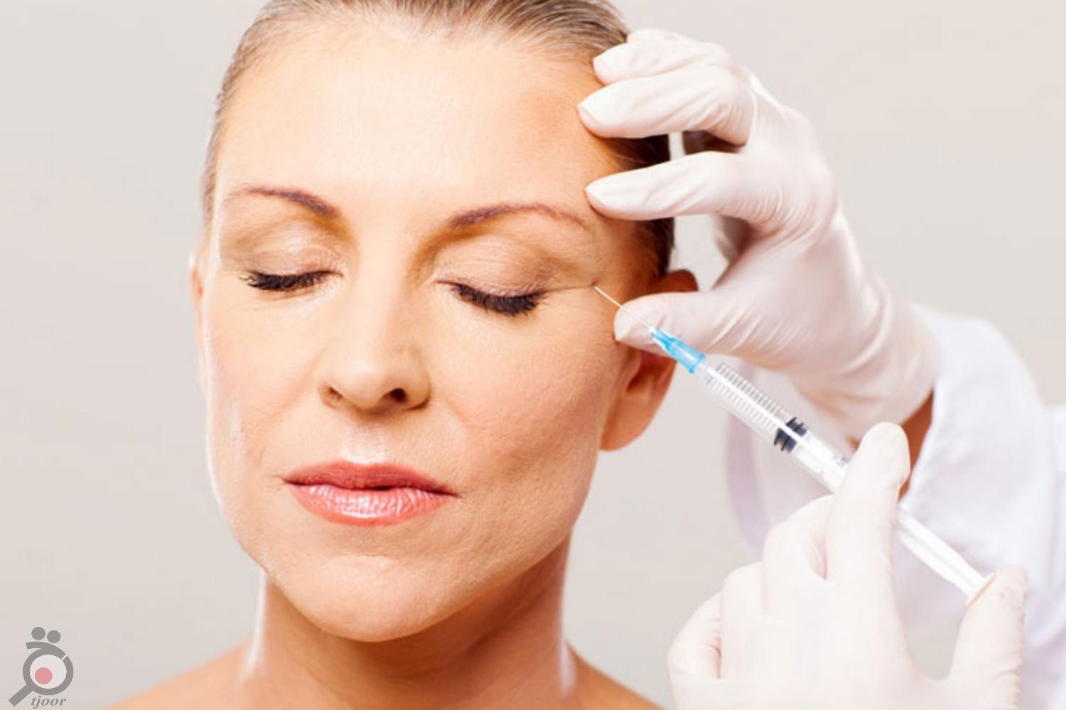 تخفیف ویژه تزریق فیلر تخفیف ویژه تزریق فیلر