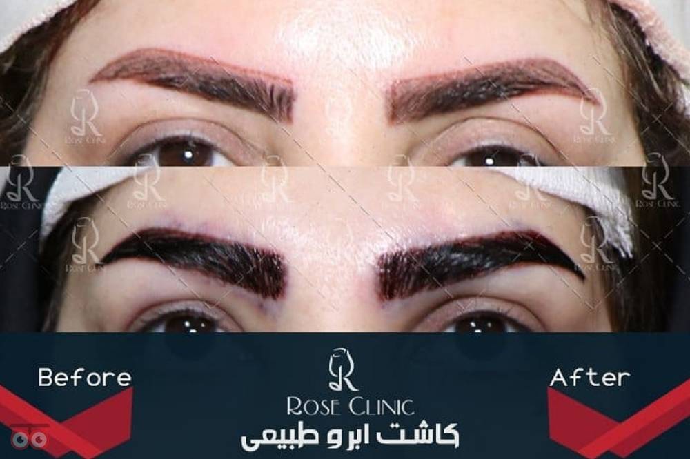 جشنواره کلینیک رز جشنواره کلینیک رز