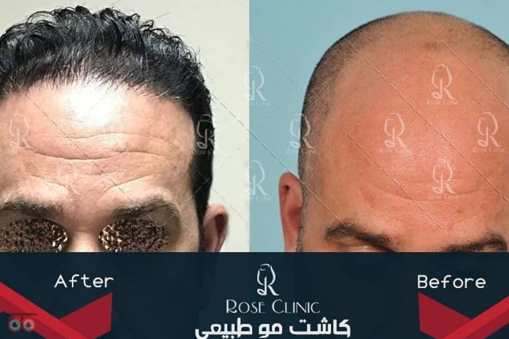 جشنواره کلینیک رز جشنواره کلینیک رز