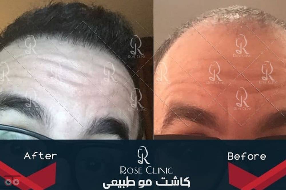 جشنواره کلینیک رز جشنواره کلینیک رز