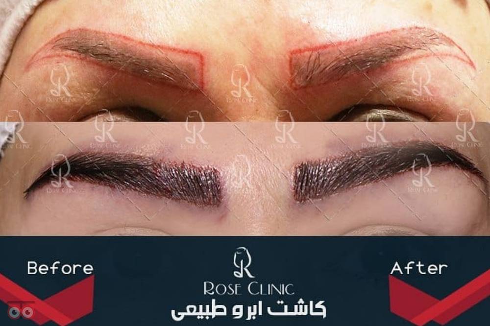 جشنواره کلینیک رز جشنواره کلینیک رز