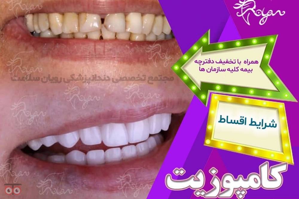 تخفیف ویژه خدمات درمانی دهان و دندان تخفیف ویژه خدمات درمانی دهان و دندان