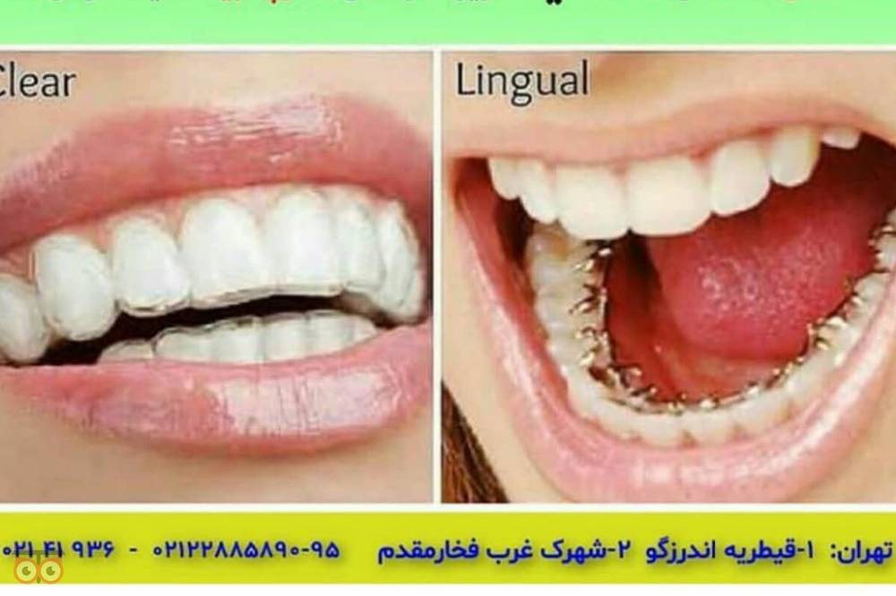 تخفیف ویژه خدمات درمانی دهان و دندان تخفیف ویژه خدمات درمانی دهان و دندان