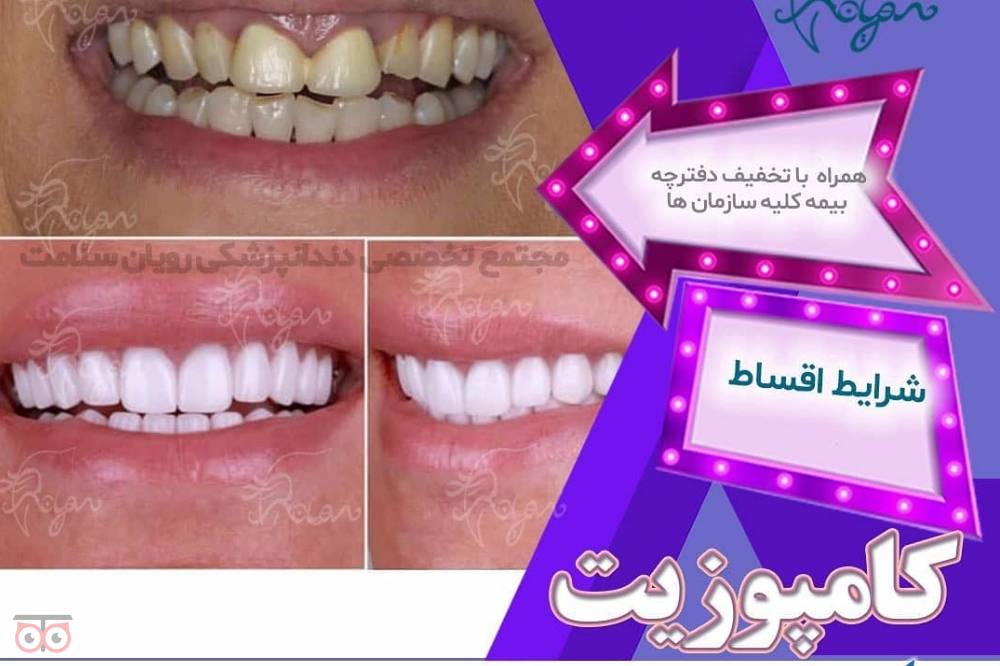 تخفیف ویژه خدمات درمانی دهان و دندان تخفیف ویژه خدمات درمانی دهان و دندان