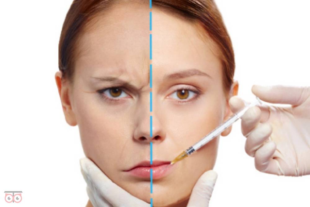 جشنواره ویژه تزریق ژل و بوتاکس جشنواره ویژه تزریق ژل و بوتاکس