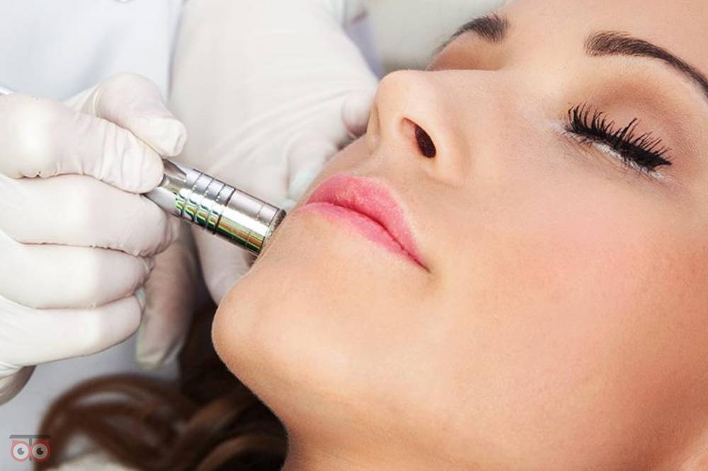 تخفیف ویژه آر اف و میکرودرم تخفیف ویژه آر اف و میکرودرم