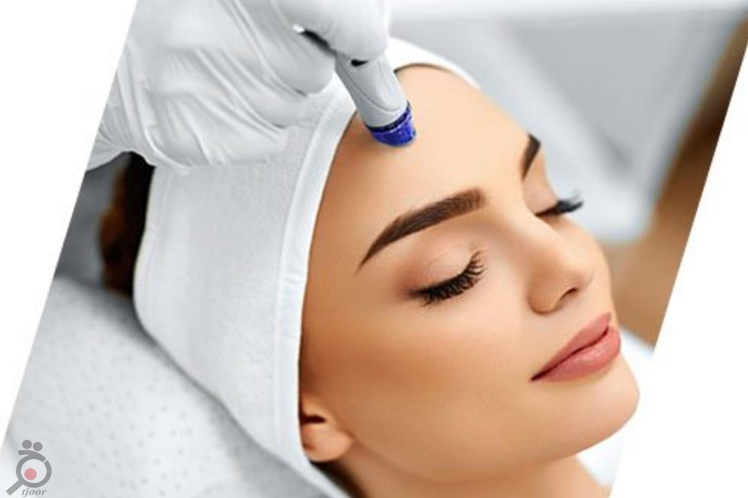 تخفیف ویژه میکرودرم ابریژن تخفیف ویژه میکرودرم ابریژن