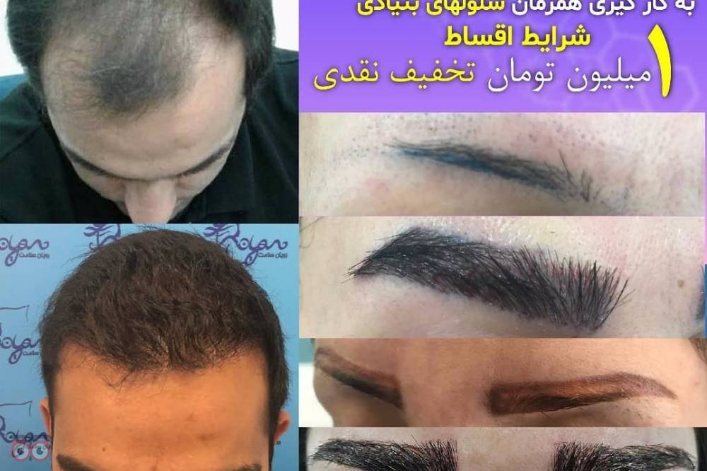 جشنواره تابستان کلینیک رویان جشنواره تابستان کلینیک رویان