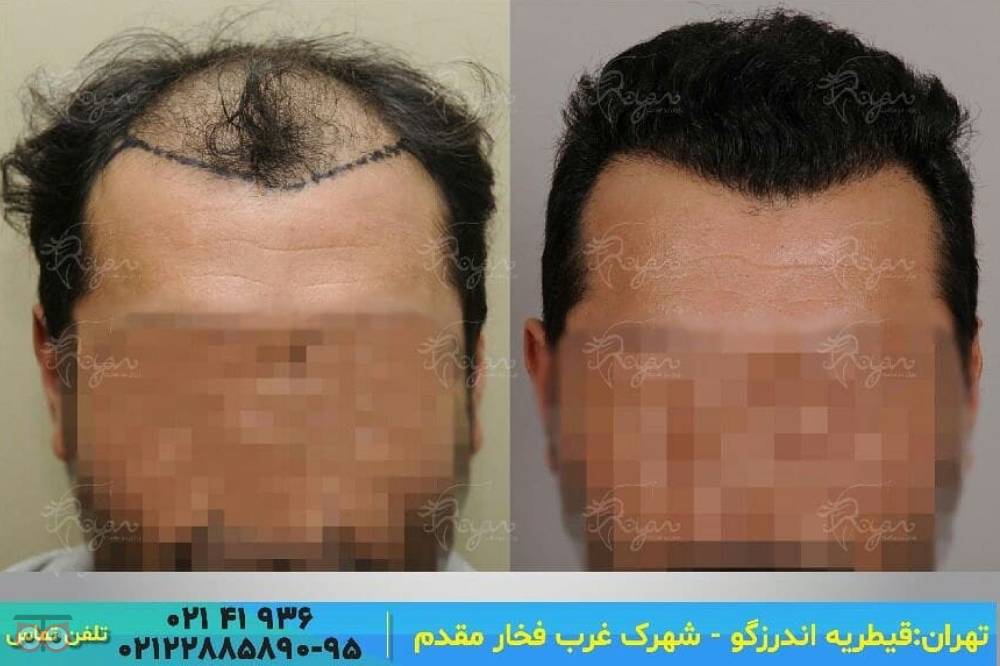 جشنواره تابستان کلینیک رویان جشنواره تابستان کلینیک رویان