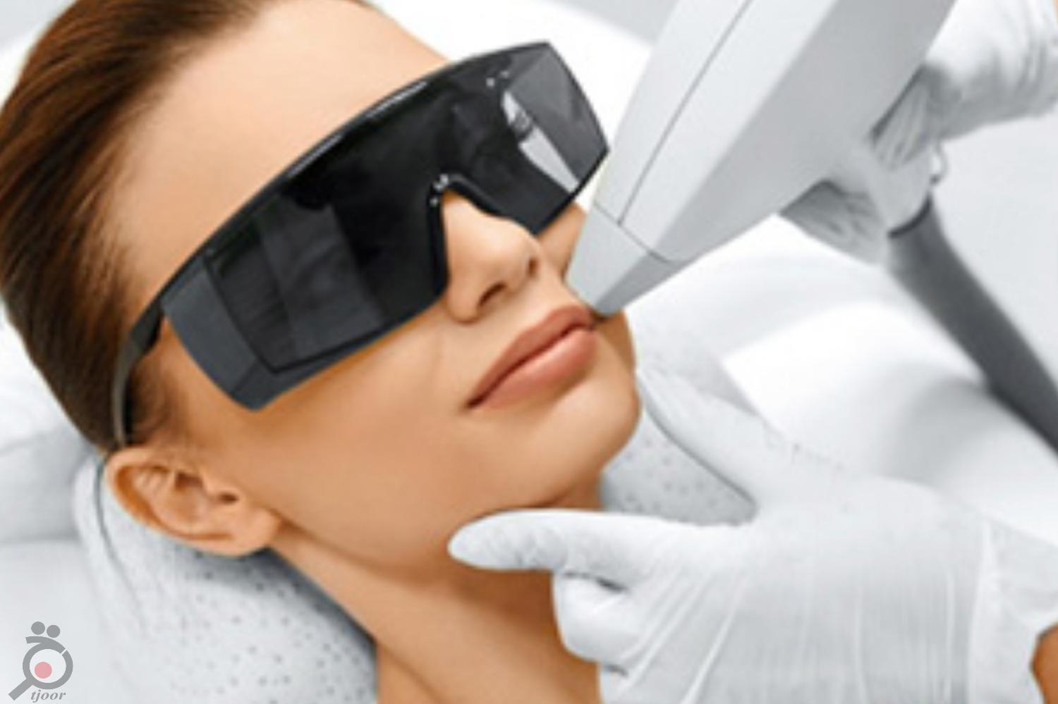 تخفیف ویژه لیزر تخفیف ویژه لیزر