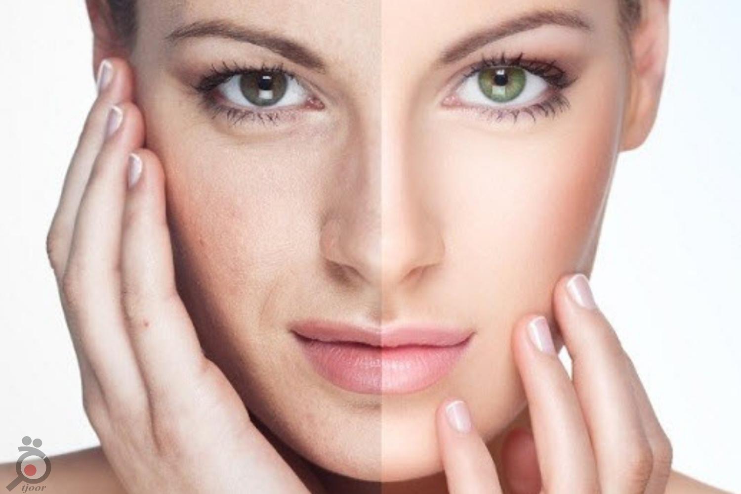 تخفیفات تابستانی بینظیر کلینیک رها تخفیفات تابستانی بینظیر کلینیک رها