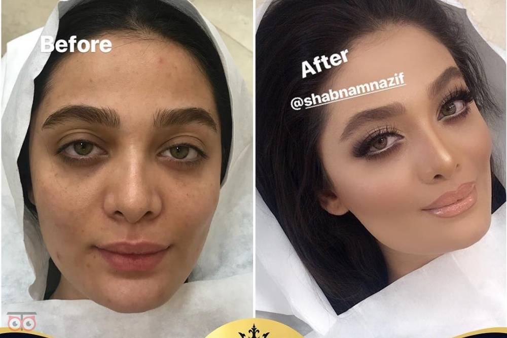 بازدید عروس همراه با آفر ویژه بازدید عروس همراه با آفر ویژه