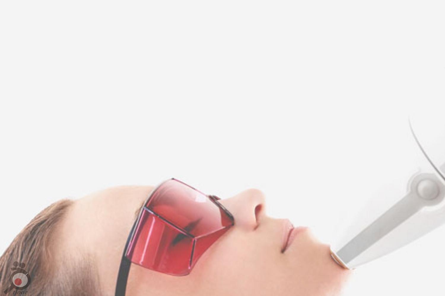 تخفیف زمستانی لیزر تخفیف زمستانی لیزر