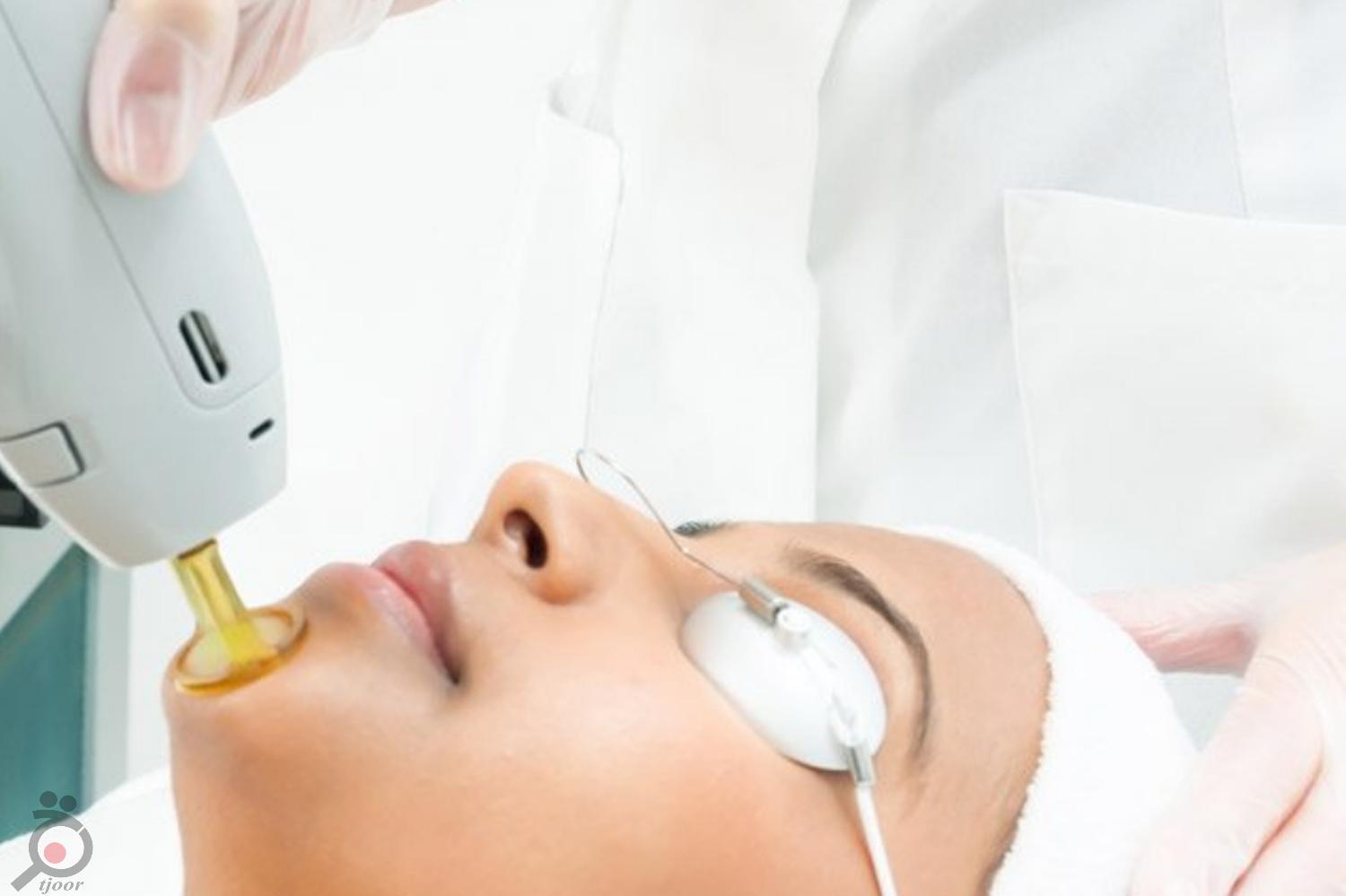 تخفیف زمستانی لیزر تخفیف زمستانی لیزر