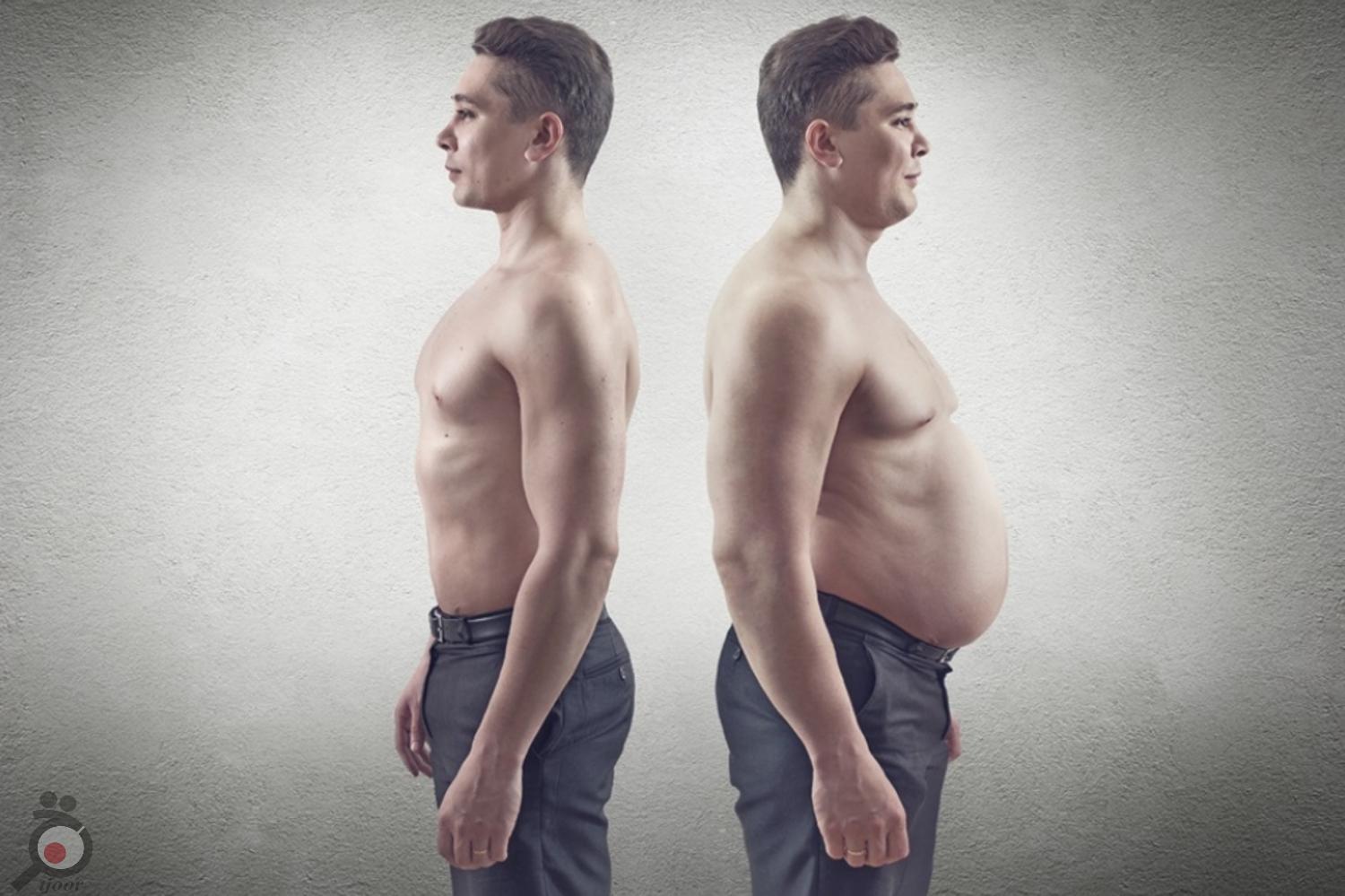 تخفیف ویژه زمستانی جراحی ماستوپکسی تخفیف ویژه زمستانی جراحی ماستوپکسی