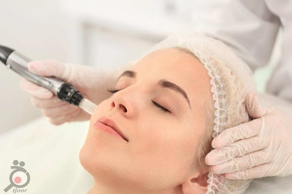 تخفیف ویژه لیزر موهای زائد در کلینیک پوست و لیزر ونوس تخفیف ویژه لیزر موهای زائد در کلینیک پوست و لیزر ونوس